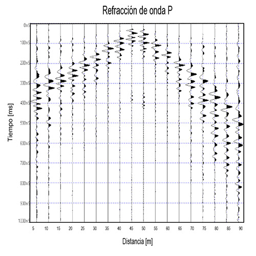Refracción de onda P